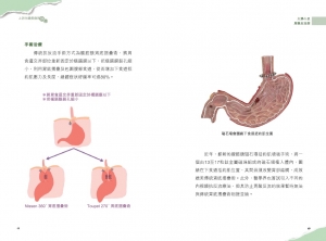 2024年10月份新書推介──MM427《上消化道疾病面面觀》_interior3