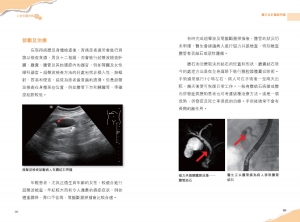 2024年10月份新書推介──MM427《上消化道疾病面面觀》_interior5